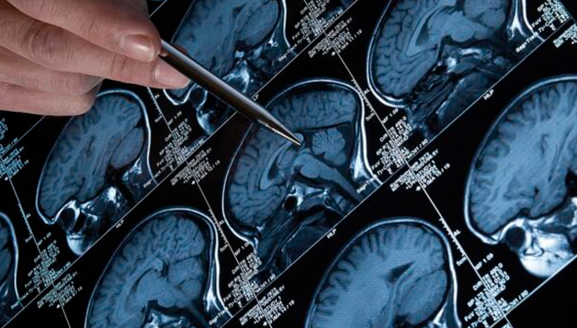 Neurology clinic in Madinaty Cairo